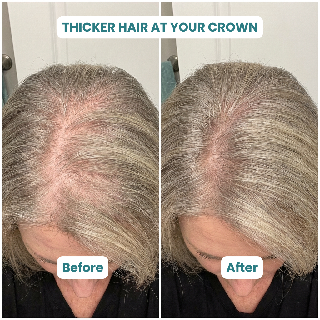 ZenLife Hair Supplement