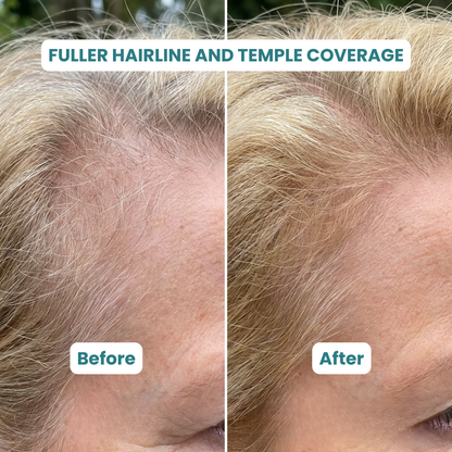 ZenLife Hair Supplement