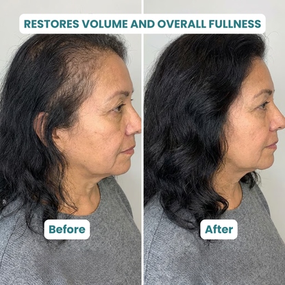 ZenLife Hair Supplement