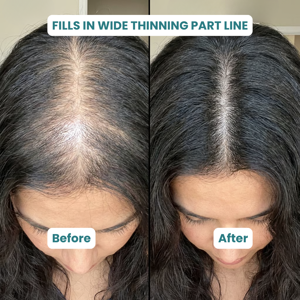 ZenLife Hair Supplement